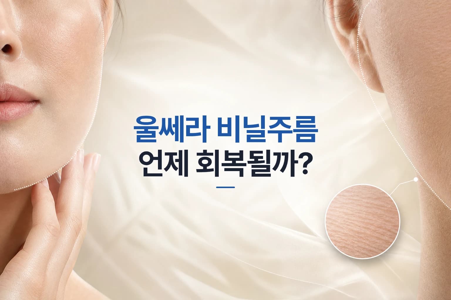 울쎄라 후 볼과 턱선 피부에 잔주름이 겹쳐 보이는 표면 변화를 담은 비닐주름 썸네일
