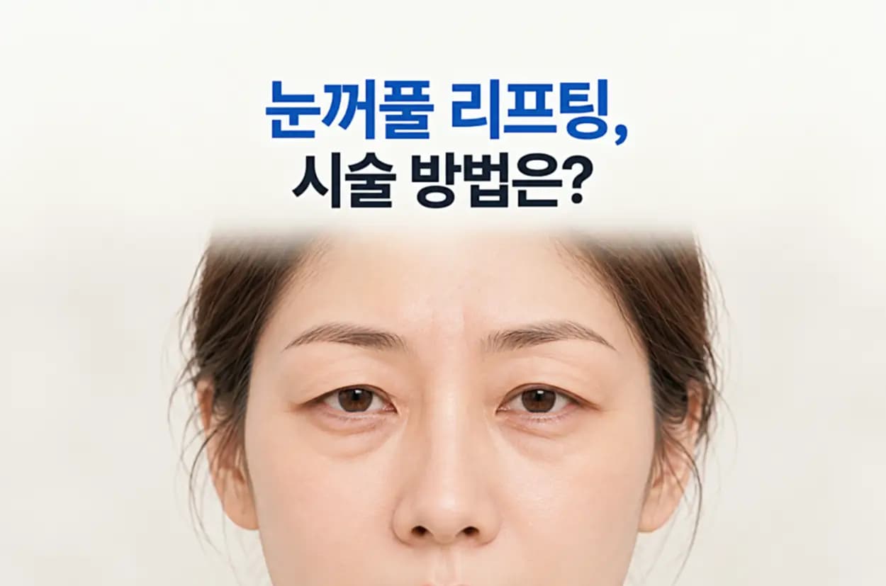 눈꺼풀 리프팅 시술 방법을 안내하는 대표 이미지로, 눈꺼풀 처짐과 눈가 주름이 나타난 여성의 눈 주변 모습을 보여주는 썸네일
