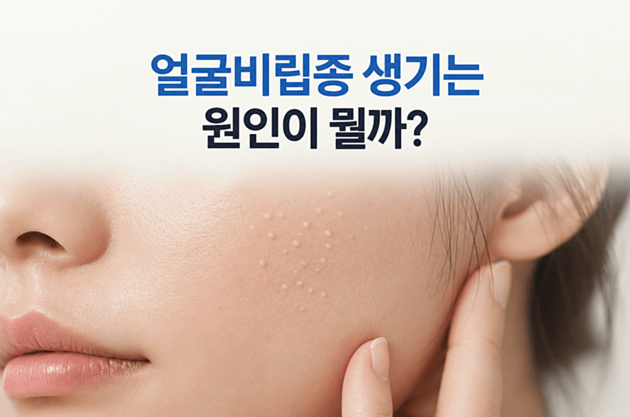 얼굴비립종 원인이 궁금한 분들을 위한 볼 부위의 하얀 좁쌀 모양 비립종과 피부 상태를 보여주는 클로즈업 이미지