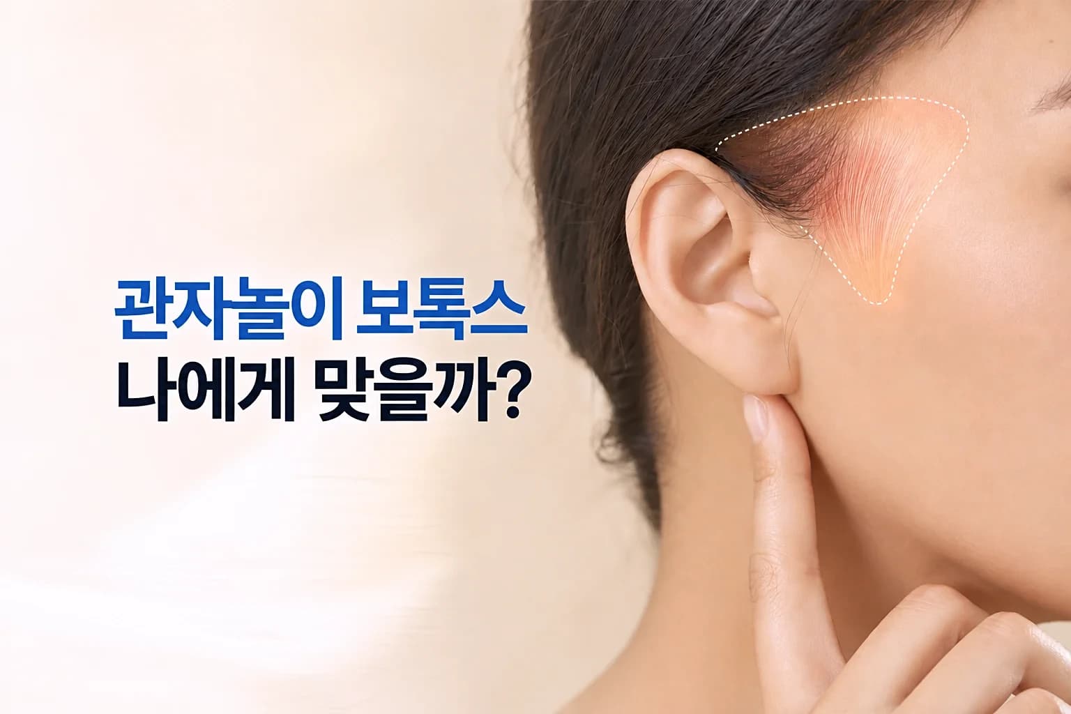 측두근 위치와 이를 악물 때 불룩해지는 관자놀이 측면을 담은 관자놀이 보톡스 썸네일
